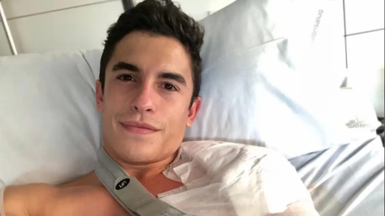 Marc Marquez Blak Blakan Soal Dampak Cedera Performa Saya Tak Pernah Sama Lagi